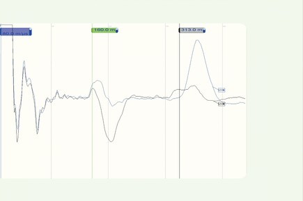 Innovation: SIM / MIM | BAUR GmbH